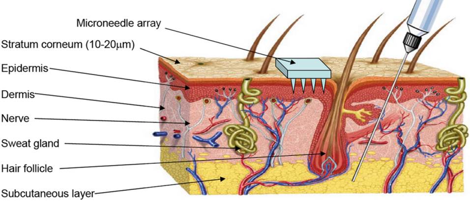 Structure of human skin – although microneedle arrays penetrate the outermost layer, they do not stimulate the nerve endings beneath